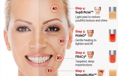 4 Stages of Fotona 4D - Non-Invasive Facelift and Skin Tightening Treatment NYC