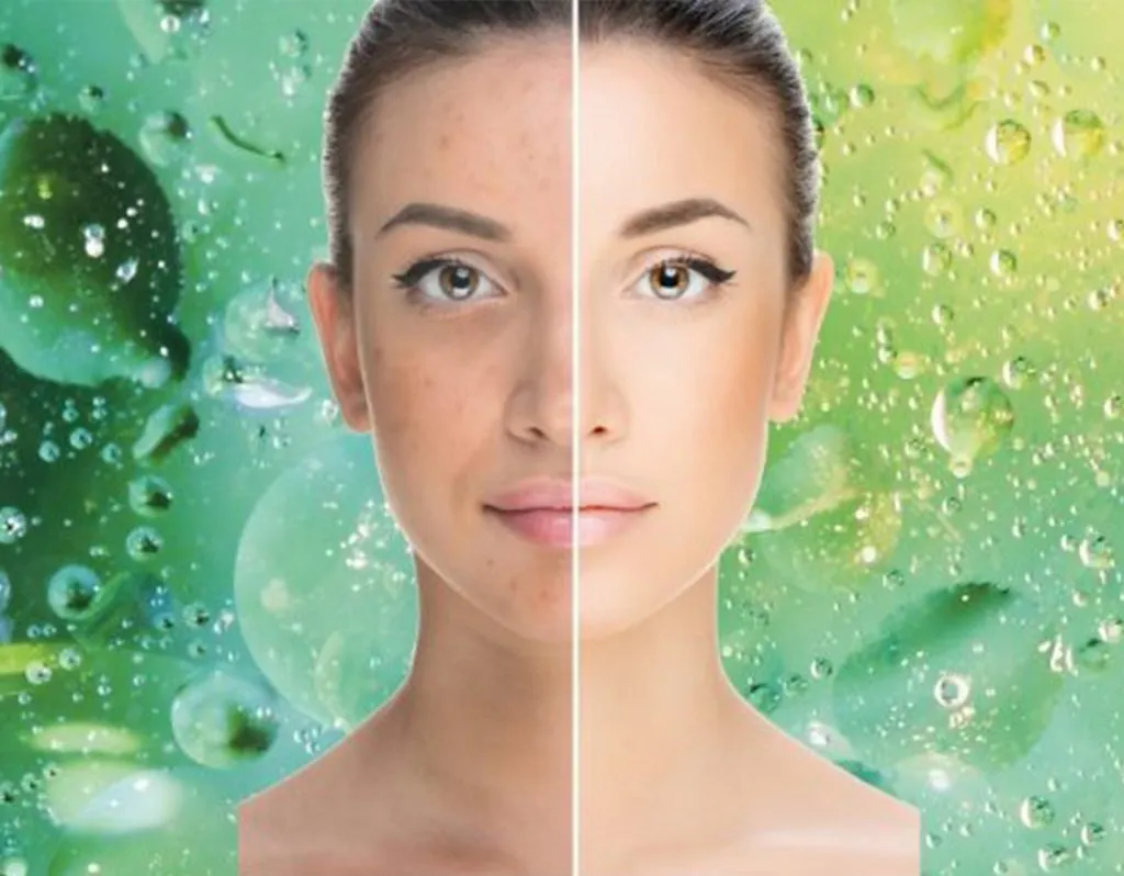 BioRePeel Chemical Peel NYC - Face Glow Skincare & Laser