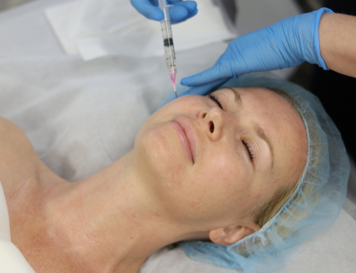 Get Glass Skin This Summer: All About Microneedling with Purasomes