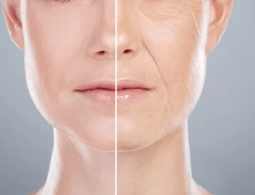 Non-Surgical Skin Tightening Explained: Why Fotona 4D is Leading the Way