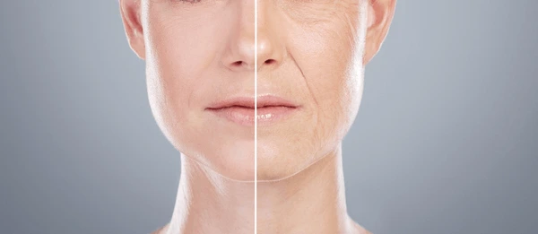 Woman with before and after aging treatment results