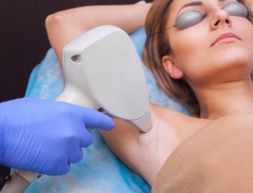 The Best Laser Hair Removal in NYC: Which Laser is Right for You?